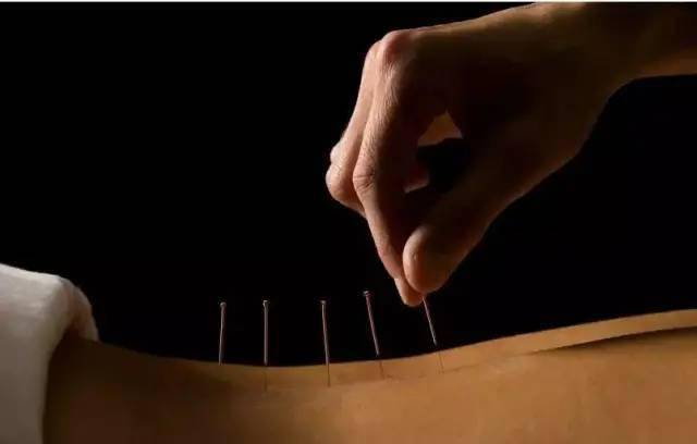 平衡針灸最新視頻，現(xiàn)代應(yīng)用探索針灸藝術(shù)的新境界