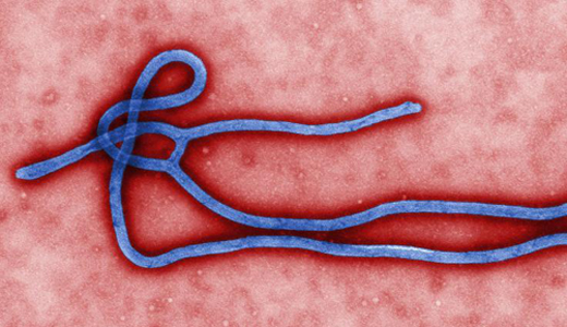 警惕最新病毒病人，你需要了解這些關(guān)鍵信息！