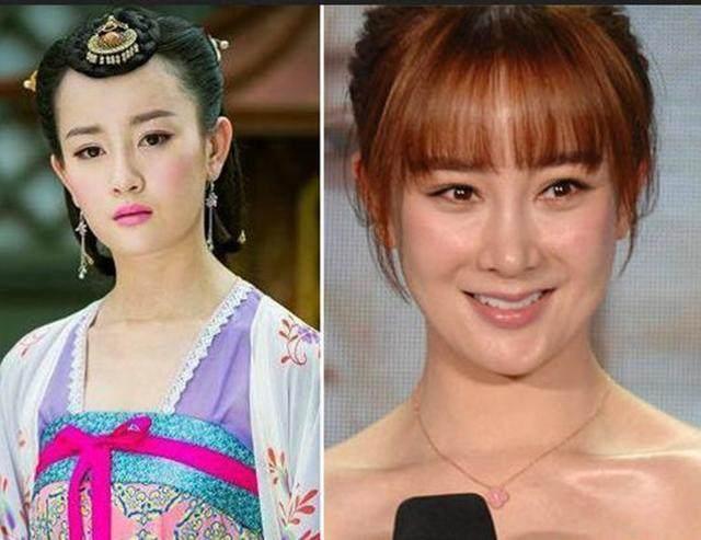 坦然面對整容，女明星的美麗新篇章之旅