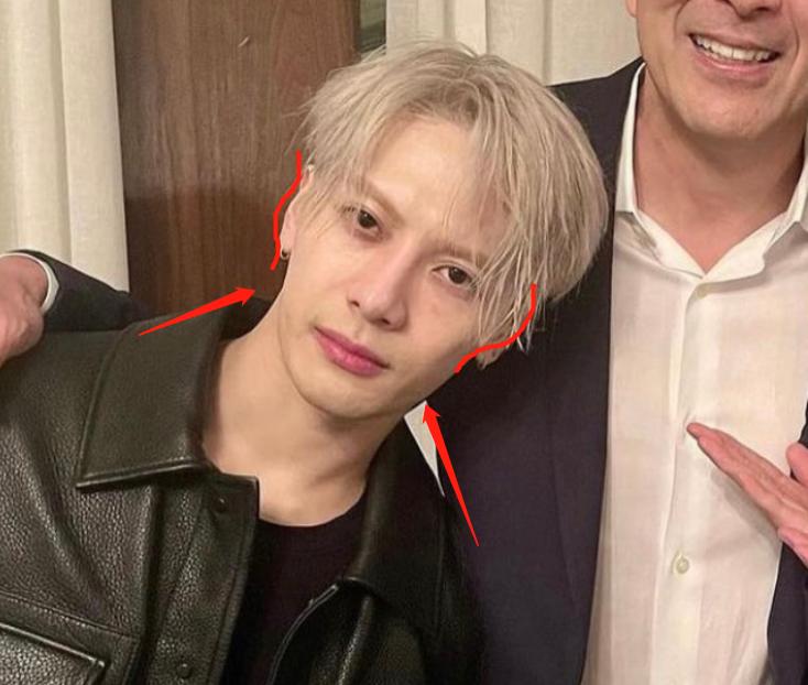 深度解析明星整容后遺癥，觀點與影響探討