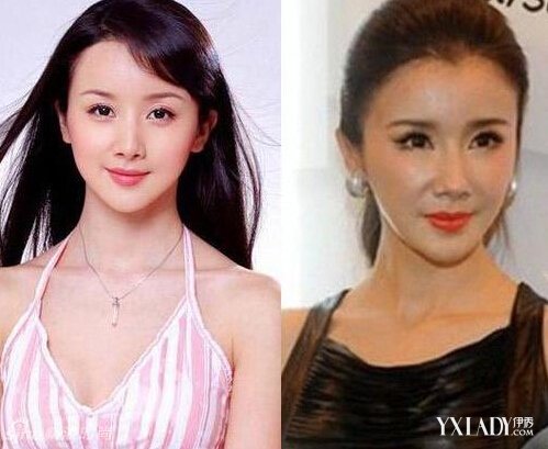 探秘明星整容的秘密，神秘美容小店的魅力所在！